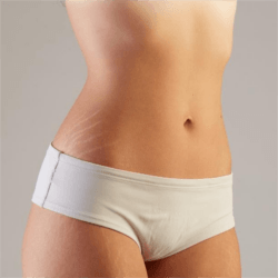 Striák elleni krémek