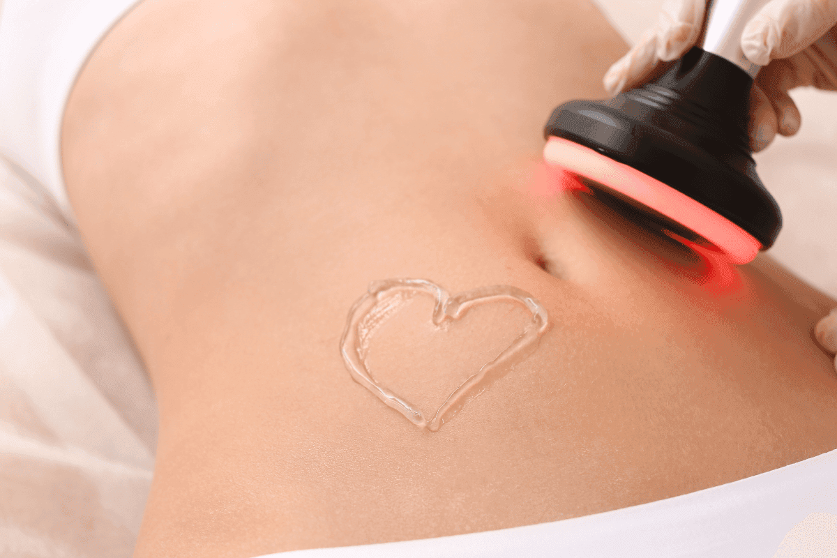 legjobb cellulitisz elleni krémek - hason