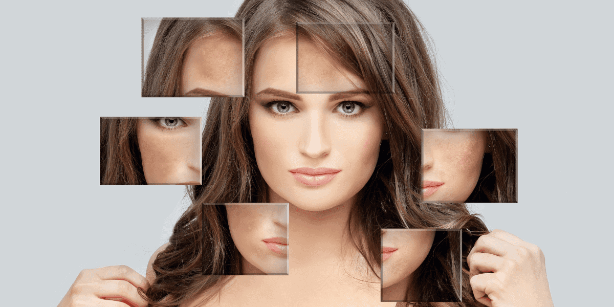 Najlepšie prípravky na pigmentové škvrny 1